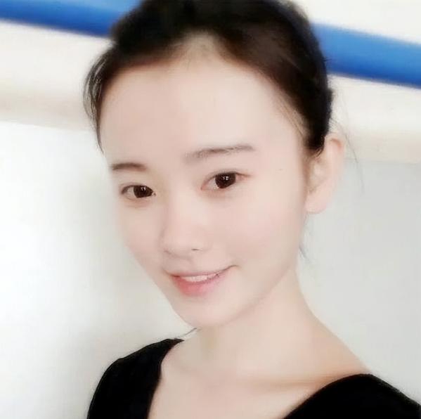 女明星也秃头？杨紫鞠婧祎全靠小心机，杨幂没刘海就是“光明顶”