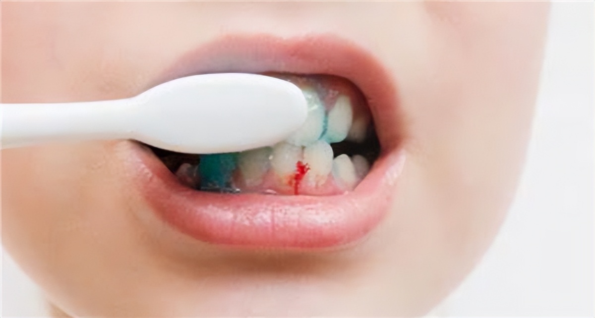 usmile和飞利浦电动牙刷测评,买电动牙刷好还是冲牙器好