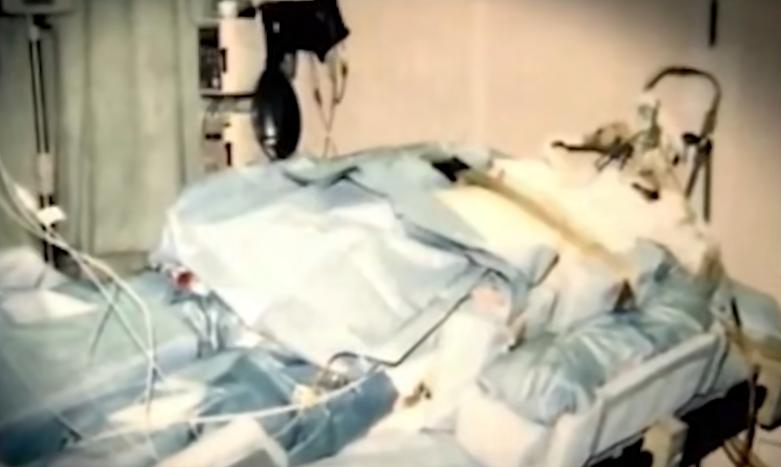 日本工人遭核辐射，被当白鼠强行续命83天，临终前烂成“烤全羊”