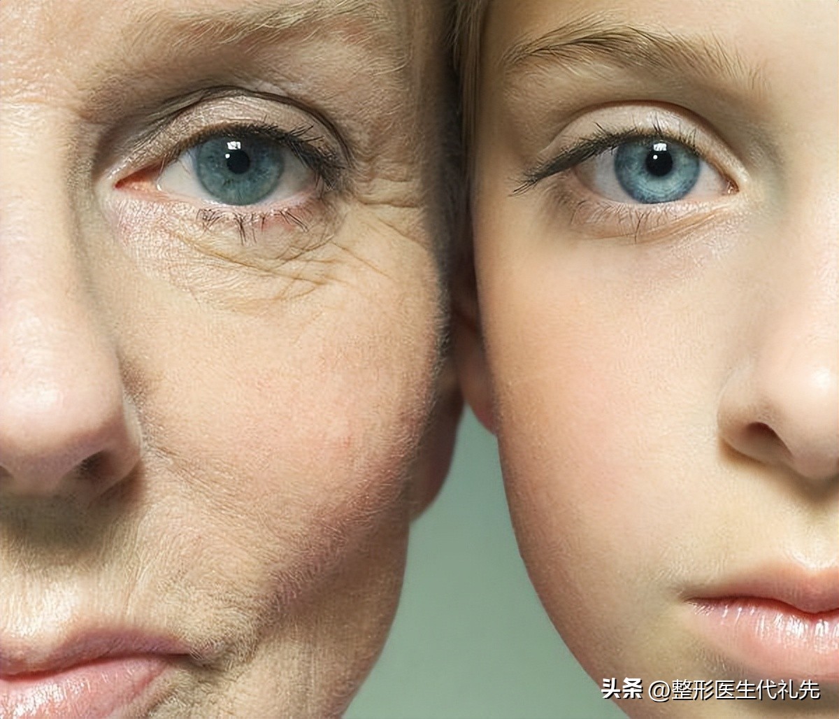 面部抗衰老的黄金三步（医生总结），40~50~60不同年龄阶段抗衰老