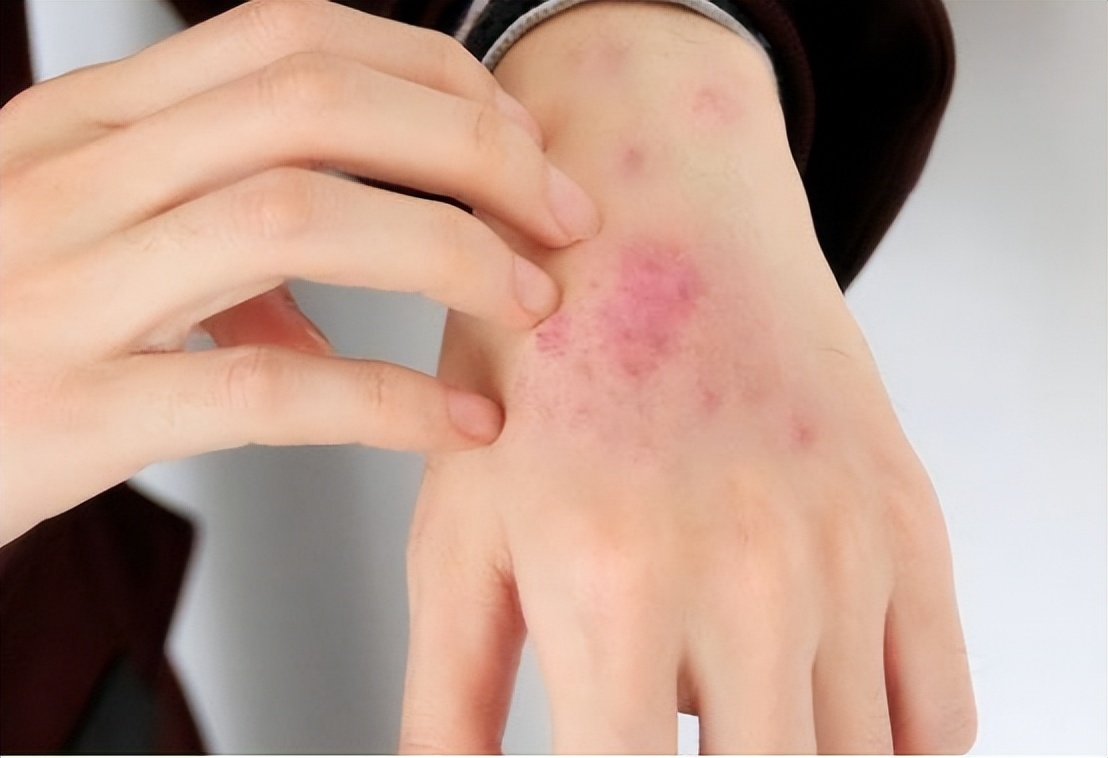 甲硝唑药治哪些病,甲硝唑便宜又好用能摆平4种病