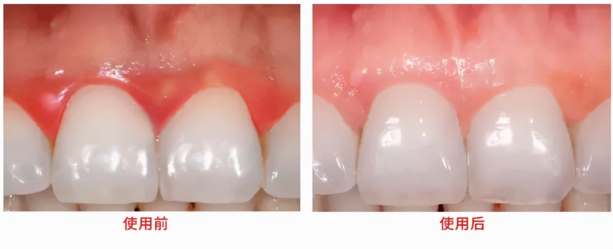 牙黄防口臭清除口腔异味的牙膏,专治牙黄口臭的牙膏正品云南白药