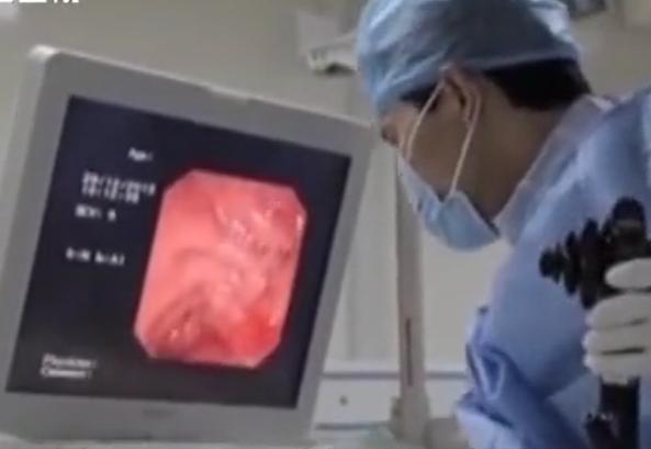 故事：湖北55岁男子病从口入，孕出成千上万虫卵，肚子竟成虫窝