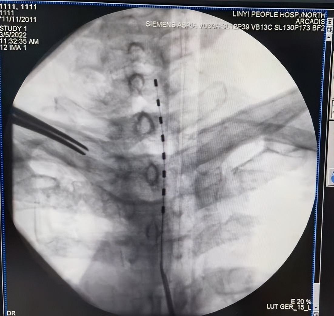 临沂市人民医院疼痛科主任,临沂市人民医院疼痛科主治什么病