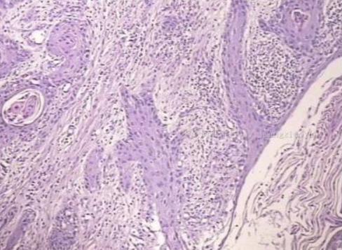 *处私**总是痒、痛，远不止阴道炎那么简单