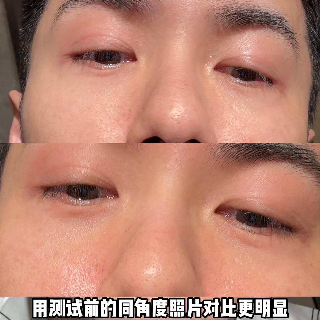 咖啡渣消眼圈，帮大家试过了。#618