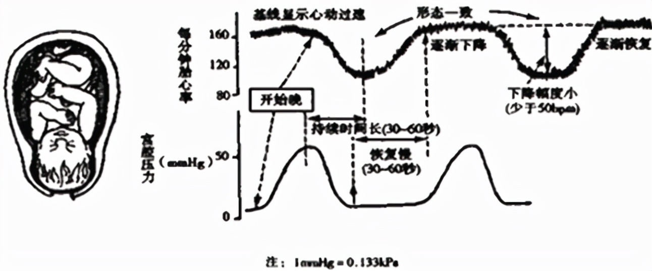 孕妈妈需要经历什么,从怀孕到生需要做多少次产检