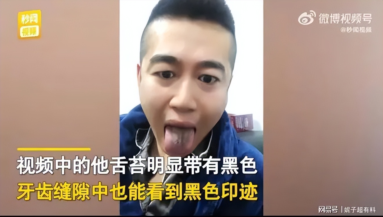 复阳的人有没有抗体,复阳是因为没换牙刷吗