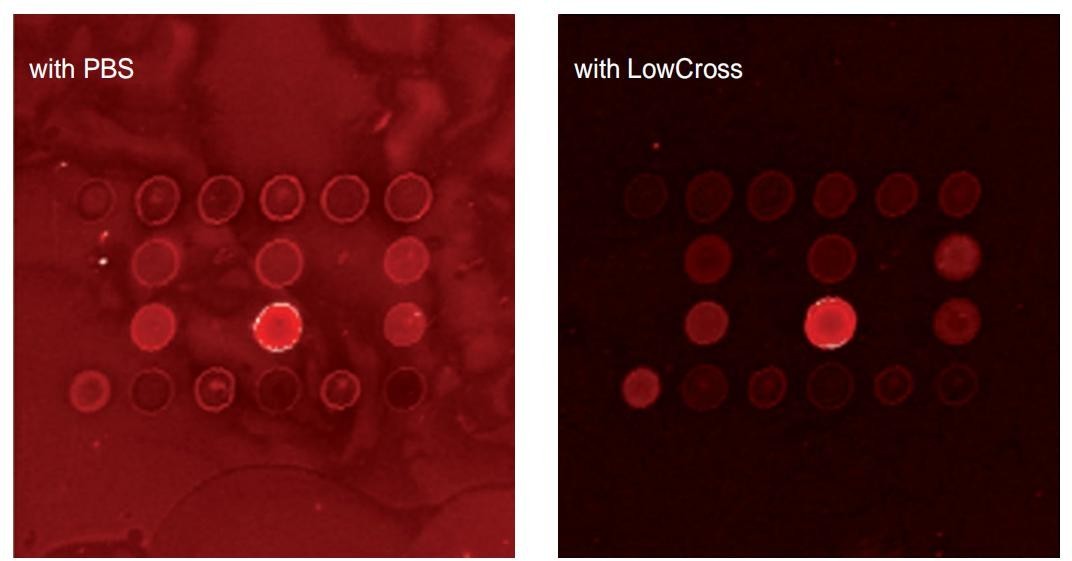 常见的免疫分析方法,免疫检验有哪些干扰