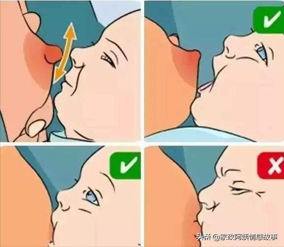 宝宝肚子胀气小偏方,突然腹胀肚子大的像皮球很硬