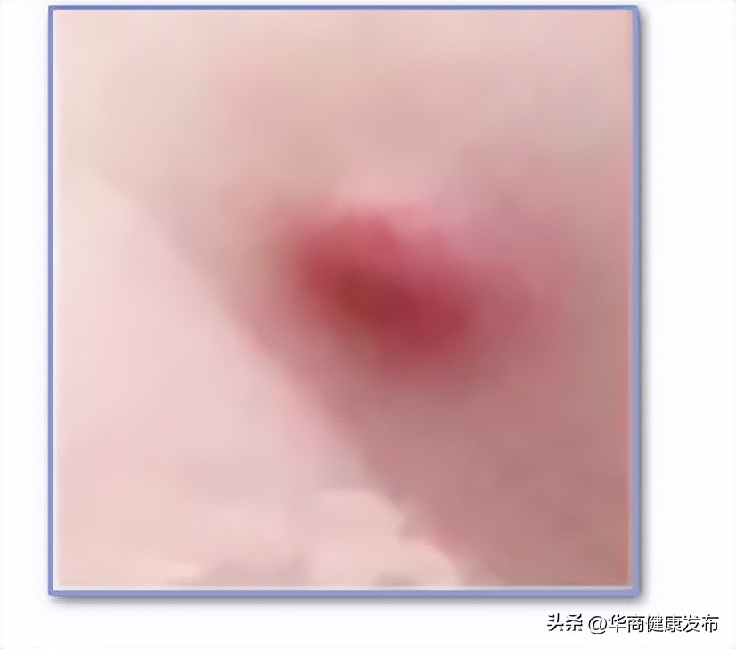 怎么知道曾经种过卡介苗,卡介苗长大后能补种吗