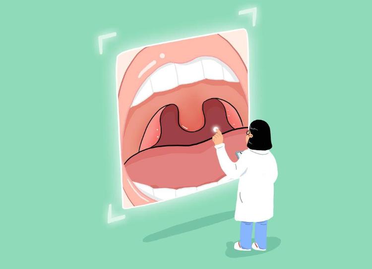 全喉切除术治疗喉癌的缺点,喉癌手术切除后吞咽困难怎么办