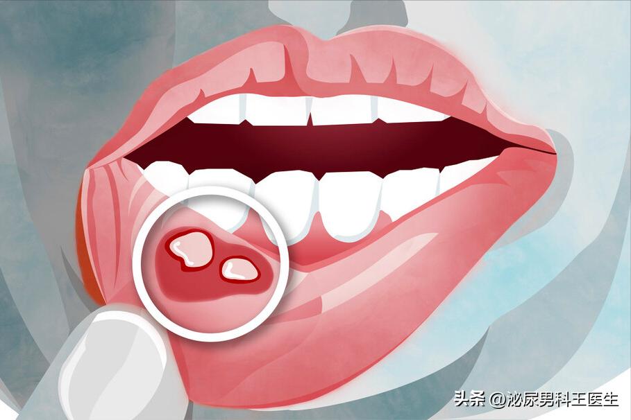 体内有癌嘴巴先知什么意思,体内有癌嘴巴会有哪些症状