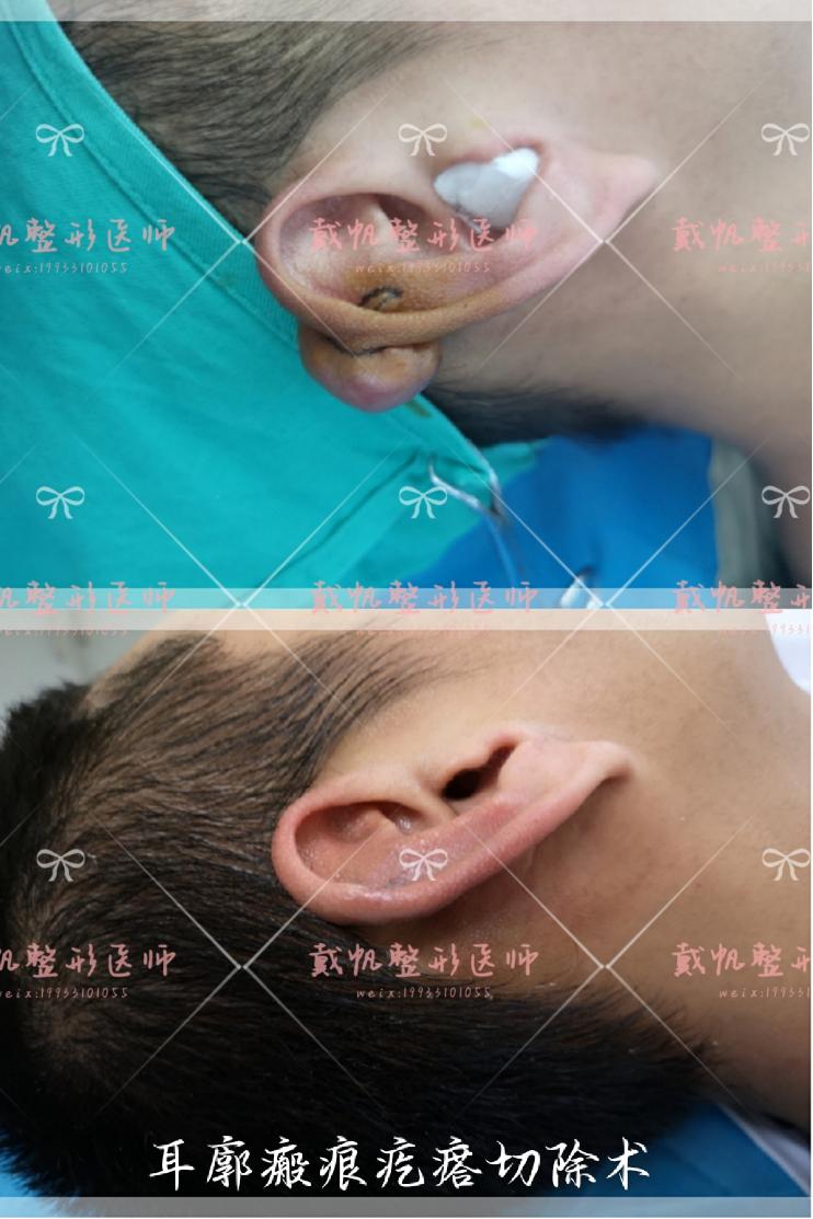 夏天美容整形,医院美容护肤项目