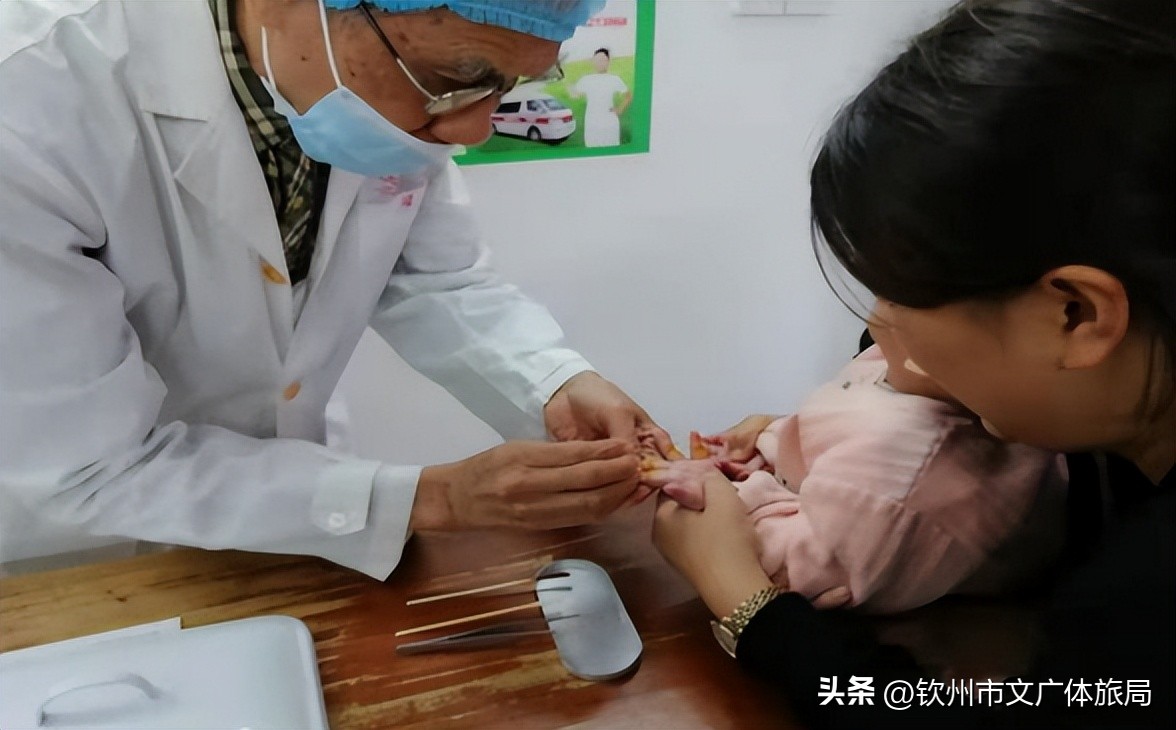 钦州针灸老中医,钦州小儿针灸