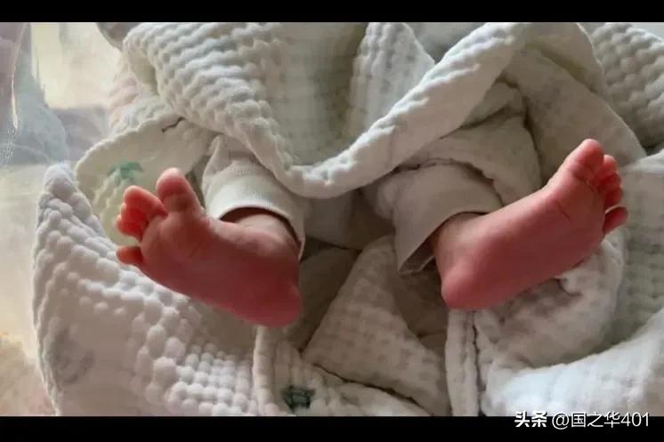 黄疸,黄疸肝炎有哪些症状