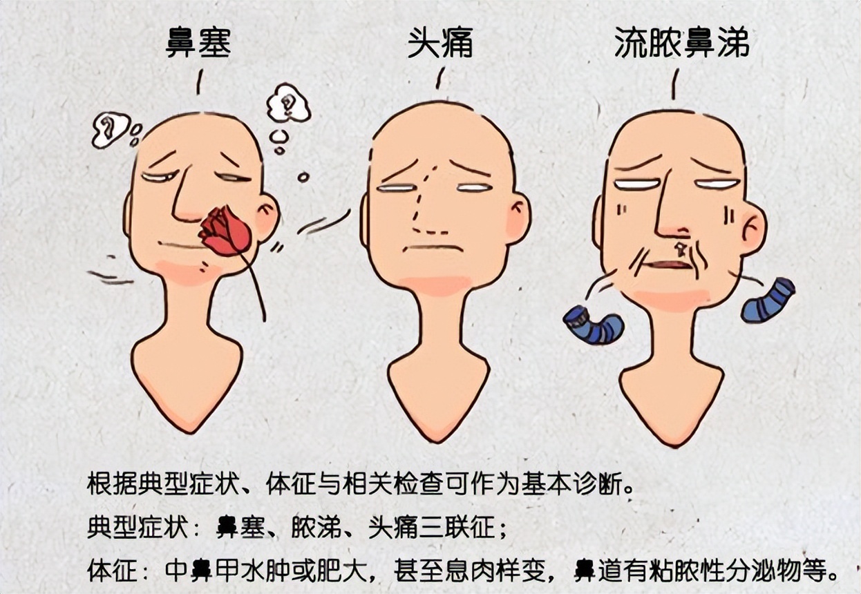 头疼鼻塞脓鼻涕是怎么回事,流鼻涕鼻塞头疼吃什么药好使