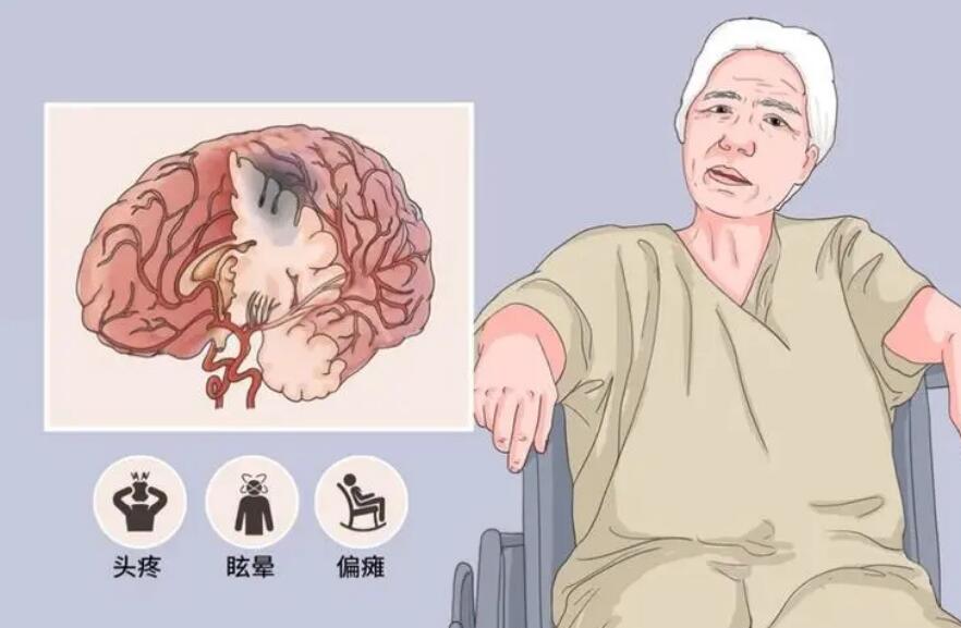 脑卒中最佳预防方法,脑卒中发病早期的护理措施