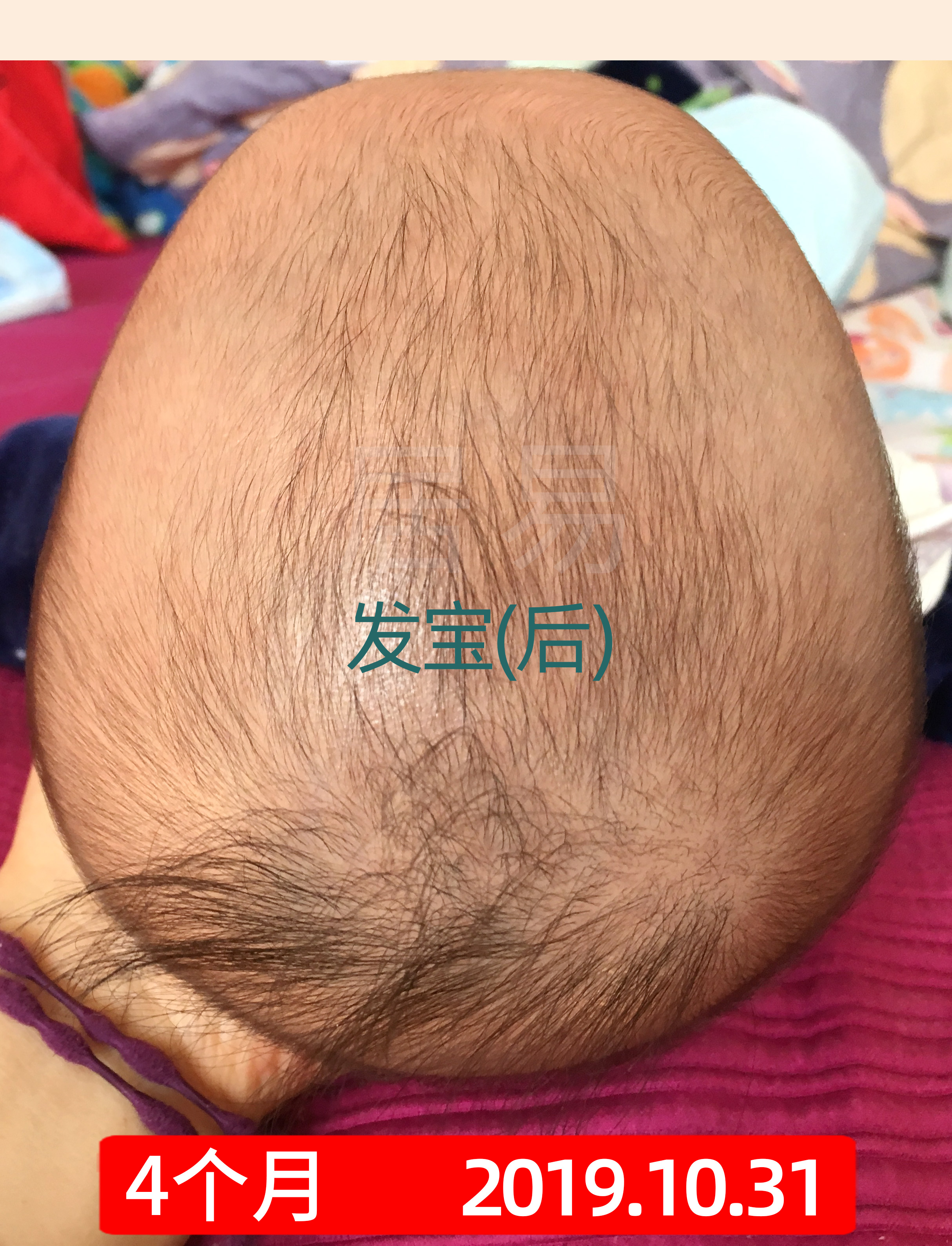 菱形头宝宝头型怎么矫正,上尖下扁头型宝宝头型怎么调整