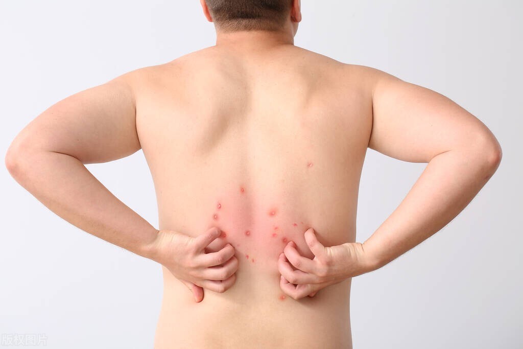 小疙瘩怎么判断是不是癌,身体出现这3个症状很抱歉