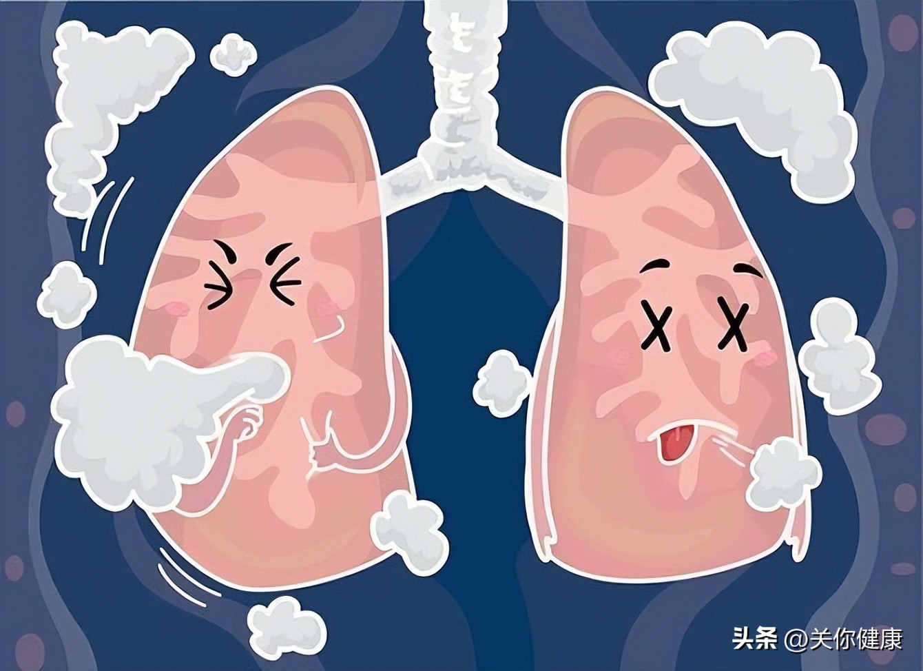 观察病人痰液颜色有什么异常,痰液观察