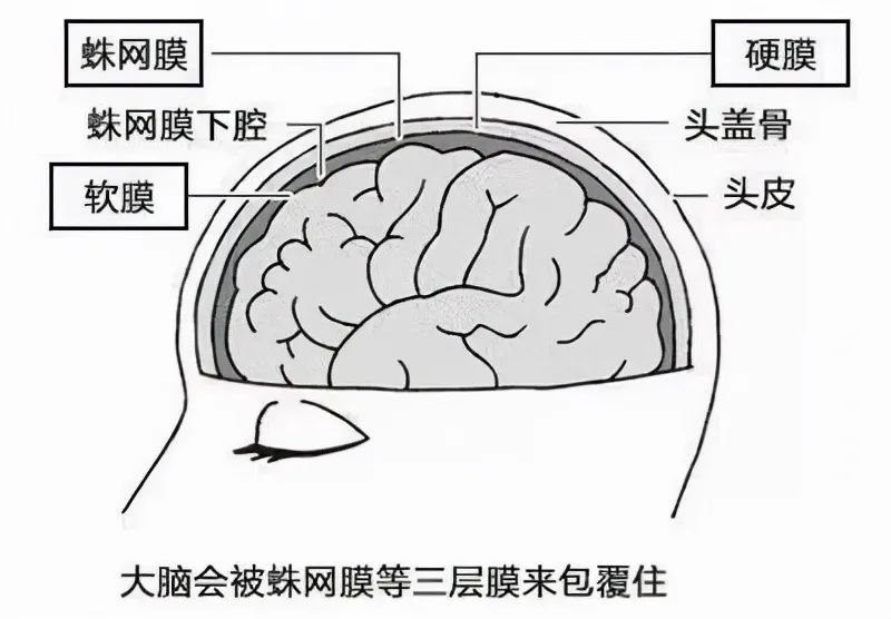 蛛网膜囊肿要不要手术,蛛网膜囊肿怎么才需要手术