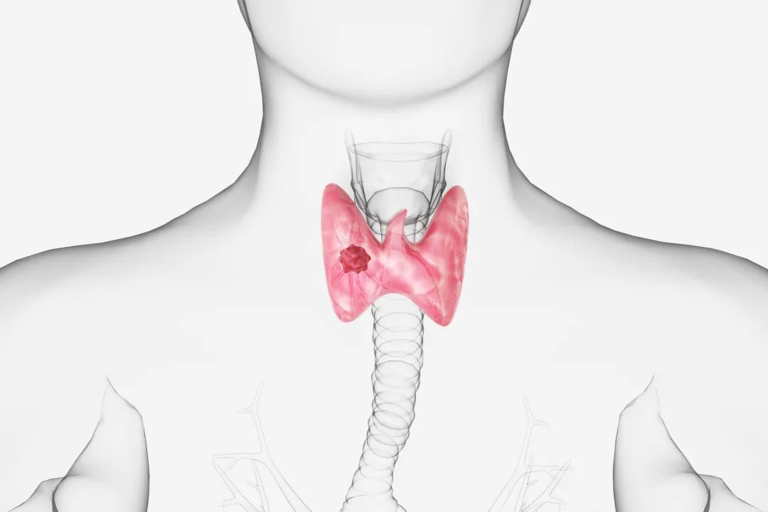 甲状腺炎超声报告单图片,怎样读懂甲状腺功能检查的报告单