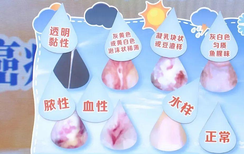 裤上有黄渍怎么办,裤头上面很黄是有炎症吗