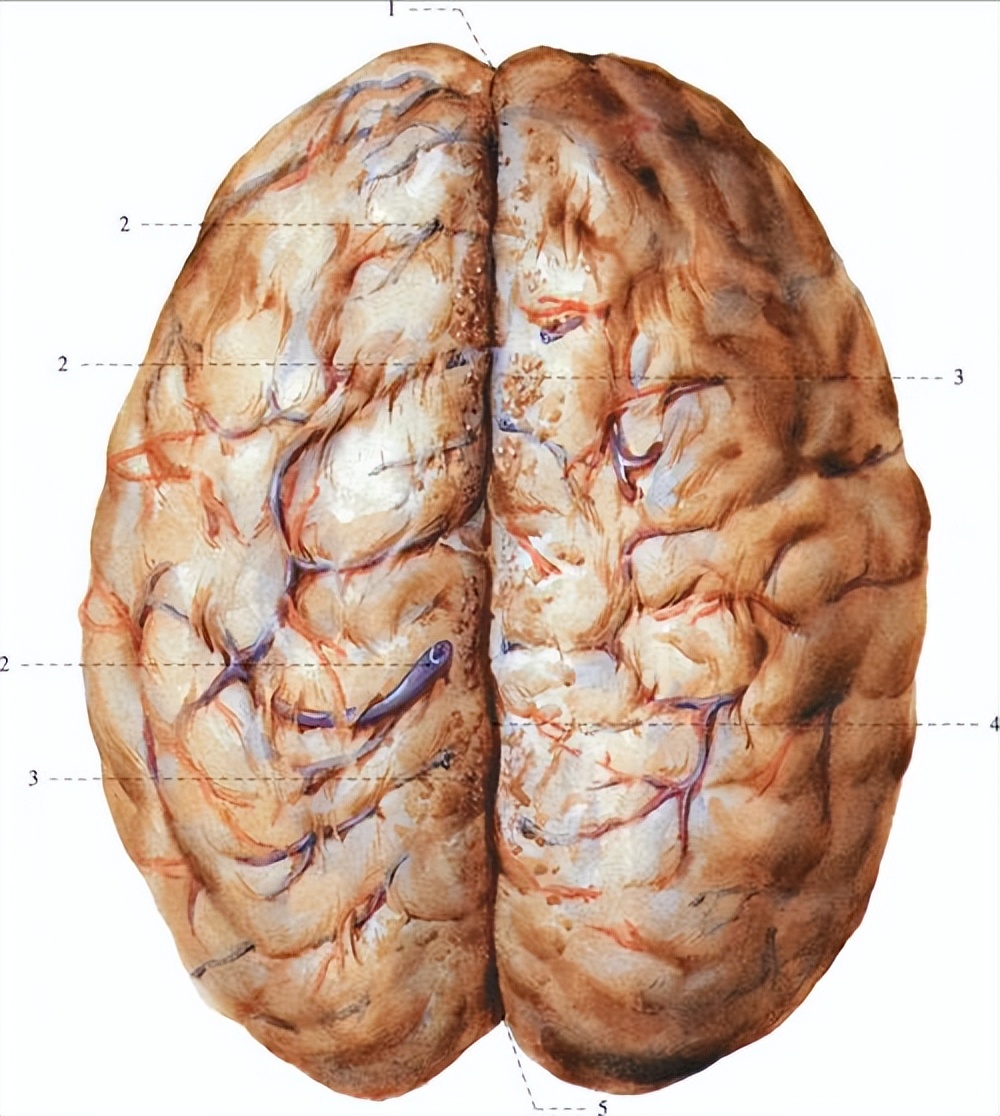 动脉瘤蛛网膜下腔出血术后并发症,动脉瘤导致蛛网膜下腔出血严重吗