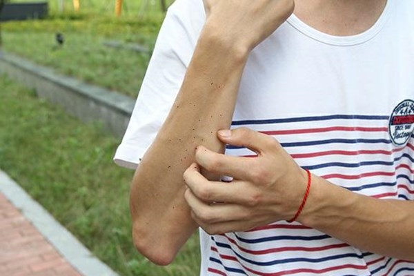 头孢阿莫西林是抗生素还是消炎药,阿莫西林和头孢消炎有什么区别