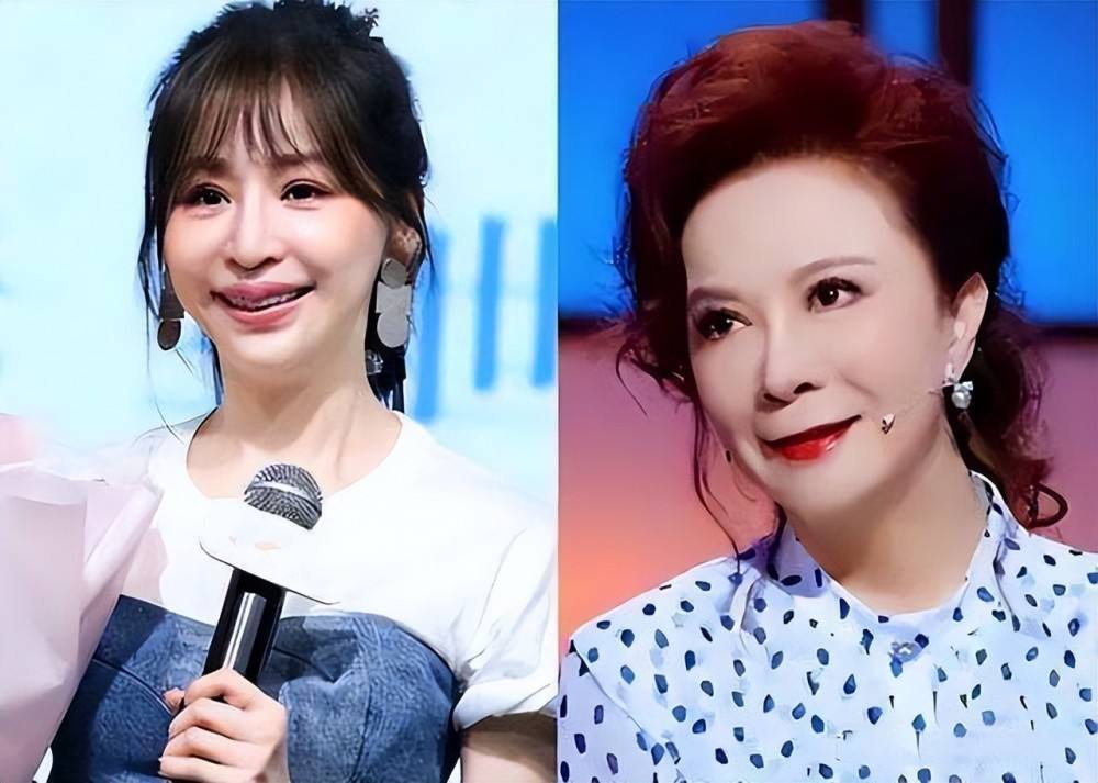 最失败硅胶脸的女星,硅胶脸女明星排行