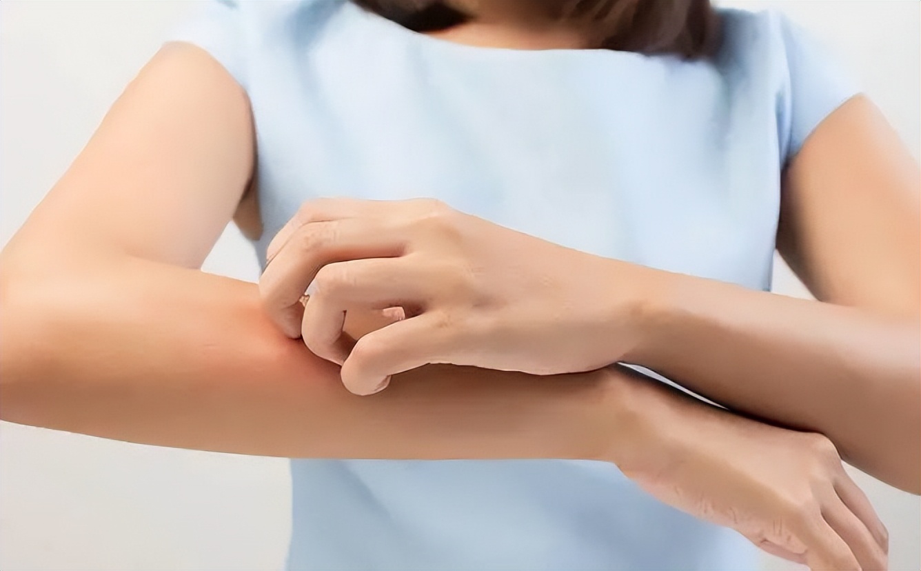 一到晚上就荨麻疹风团是什么原因,皮肤瘙痒荨麻疹的原因及治疗方法