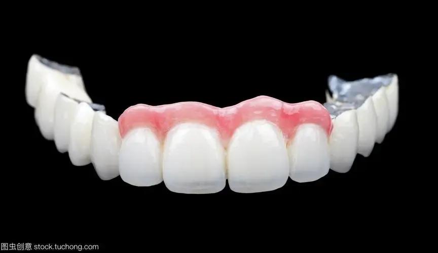 范冰冰做烤瓷牙前后照,范冰冰做的牙贴片还是烤瓷牙