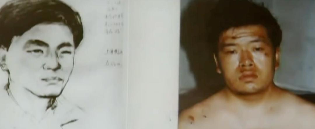 20岁女人整容失败案例,女人整容失败电视剧