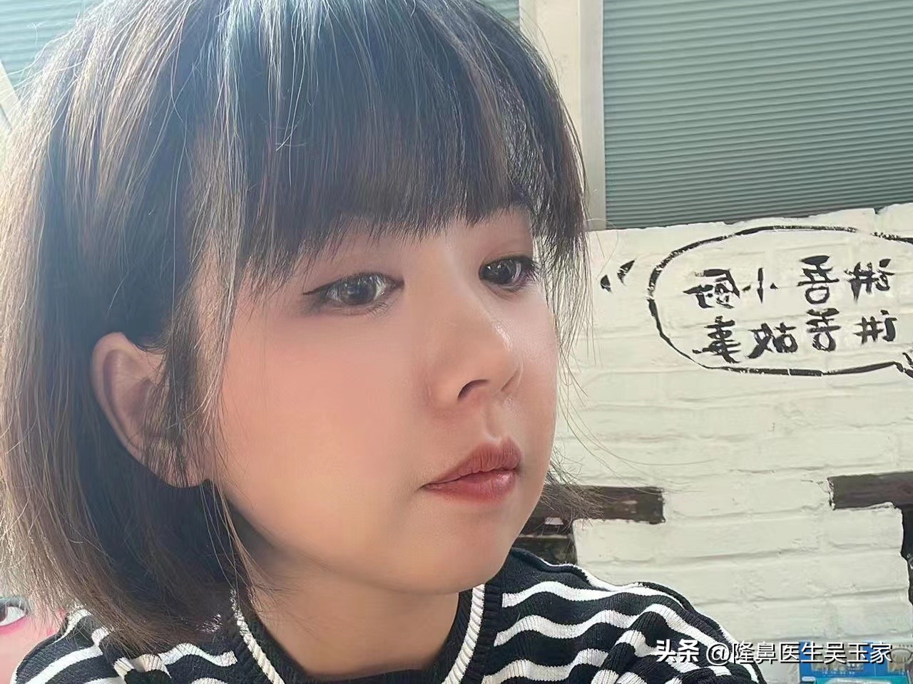 35岁去法令纹用哪个产品,去鼻纹最好的方法是什么