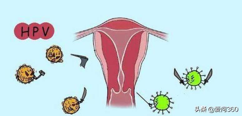 日常出现这些问题可能是宫颈炎,不要大意,做好预防措施
