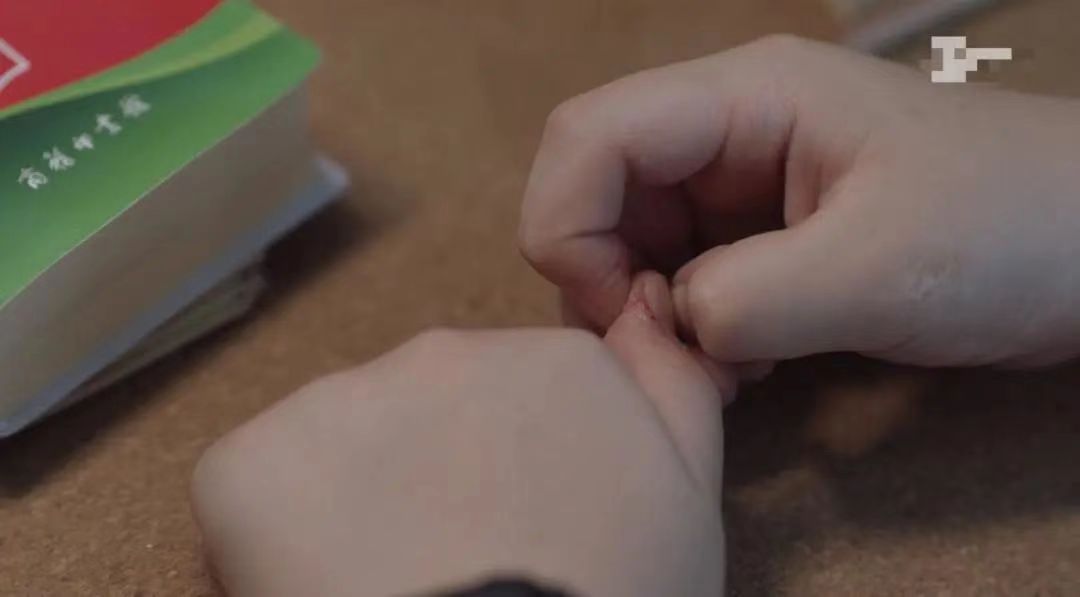 詹姆斯咬手指原因,九岁小男孩咬指甲截肢