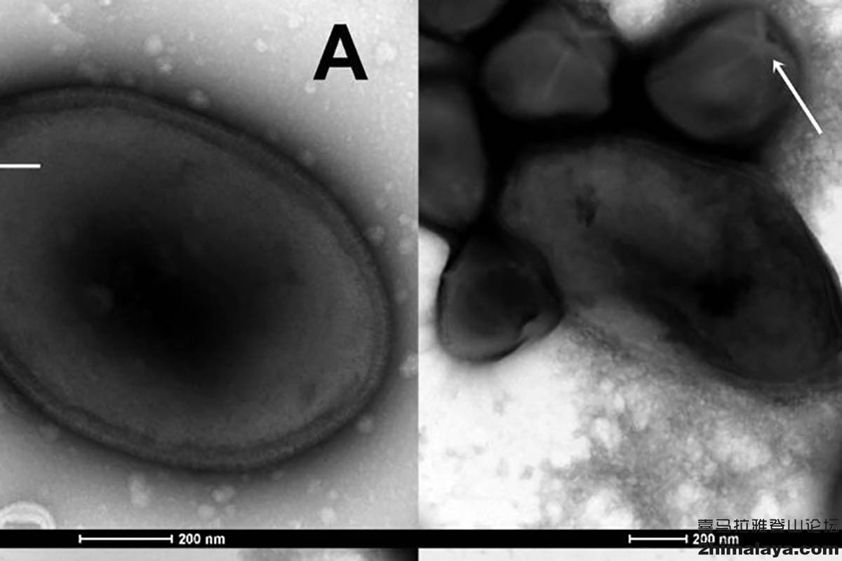 西伯利亚冻土层下面的远古病毒 (俄罗斯感染了僵尸病毒了吗)