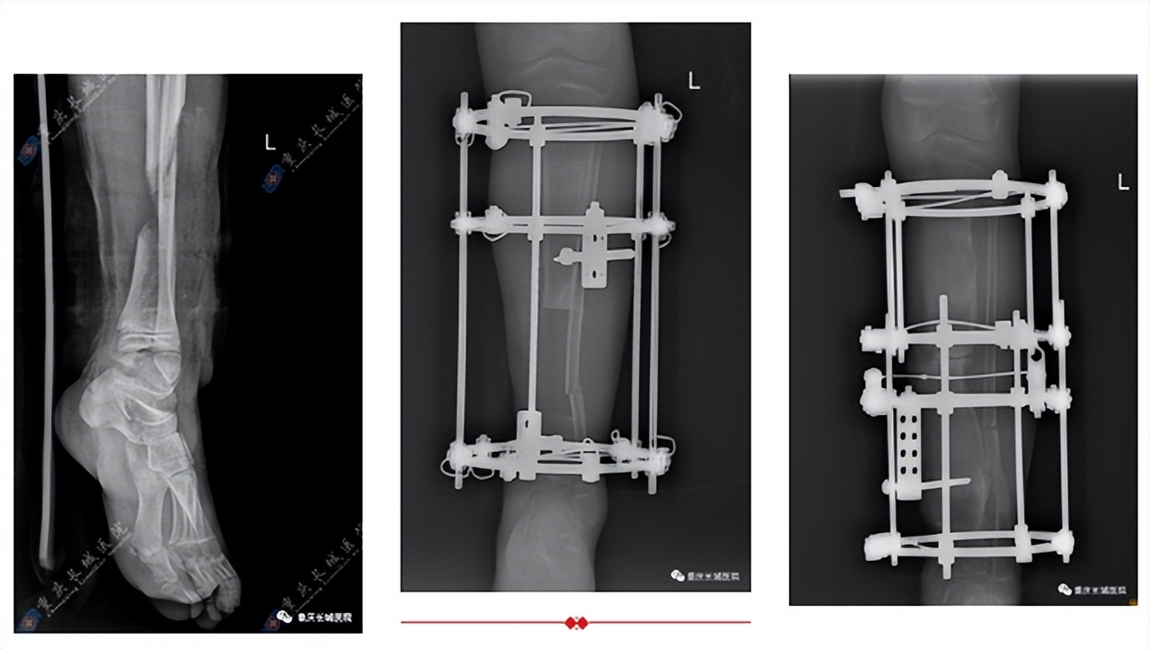 涓滴之水成海洋是什么意思,涓滴之水成海洋什么意思