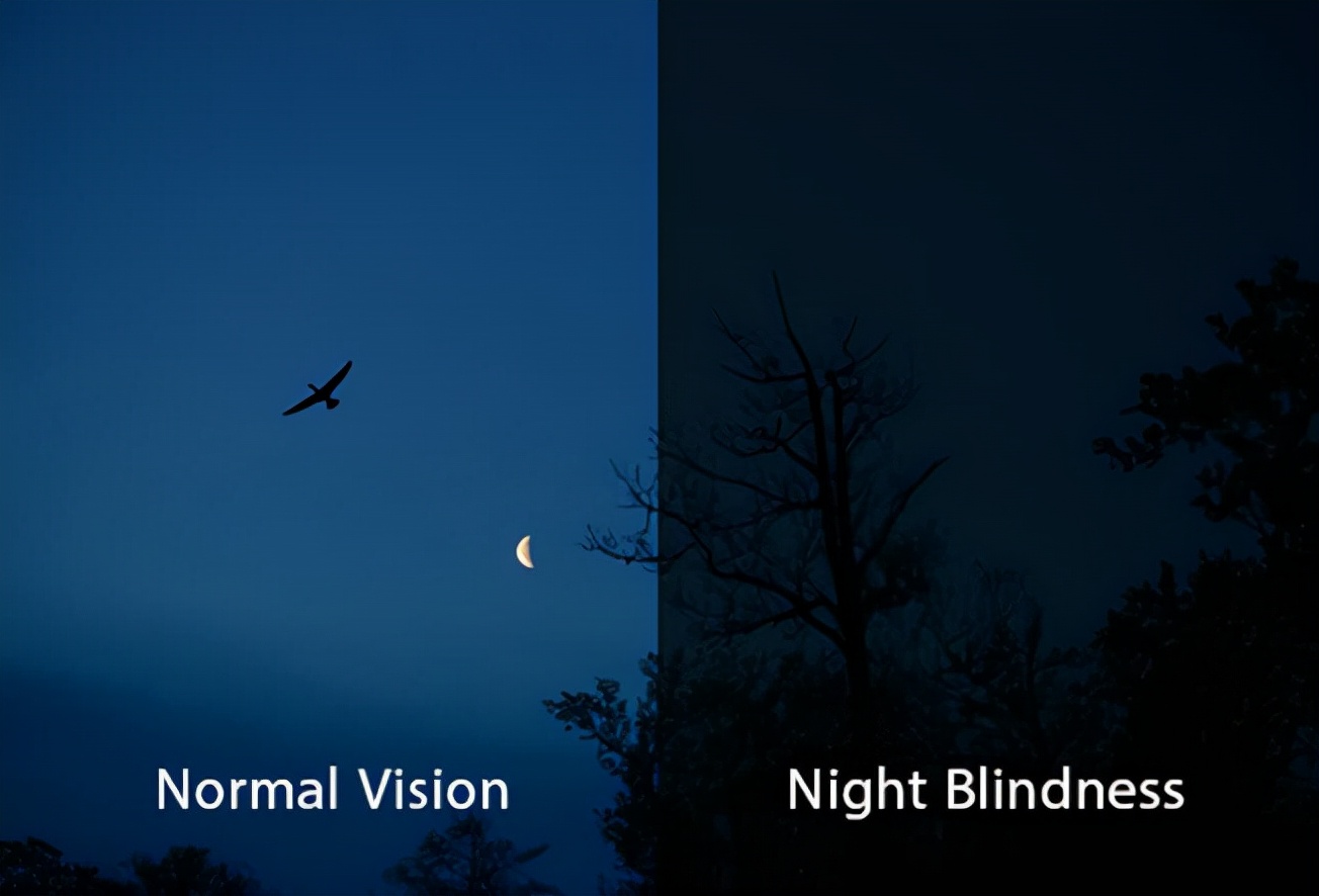 眼睛5种迹象是疾病表现,10大症状预示眼睛疾病