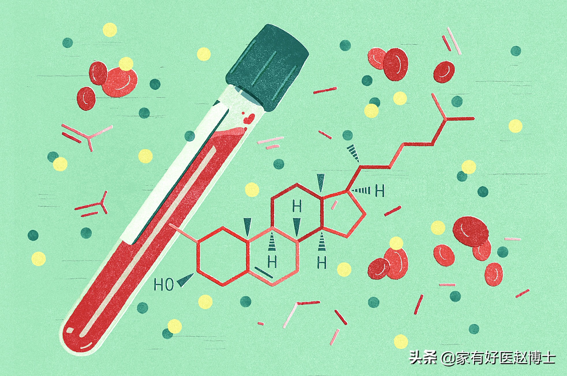影响低密度脂蛋白胆固醇的因素,影响高胆固醇血症的因素
