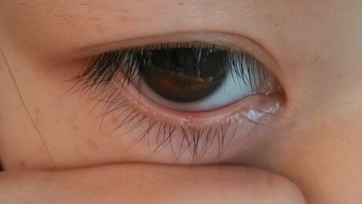 眼睛干涩、模糊，还有救吗？对眼睛好的4类营养素，早知早受益