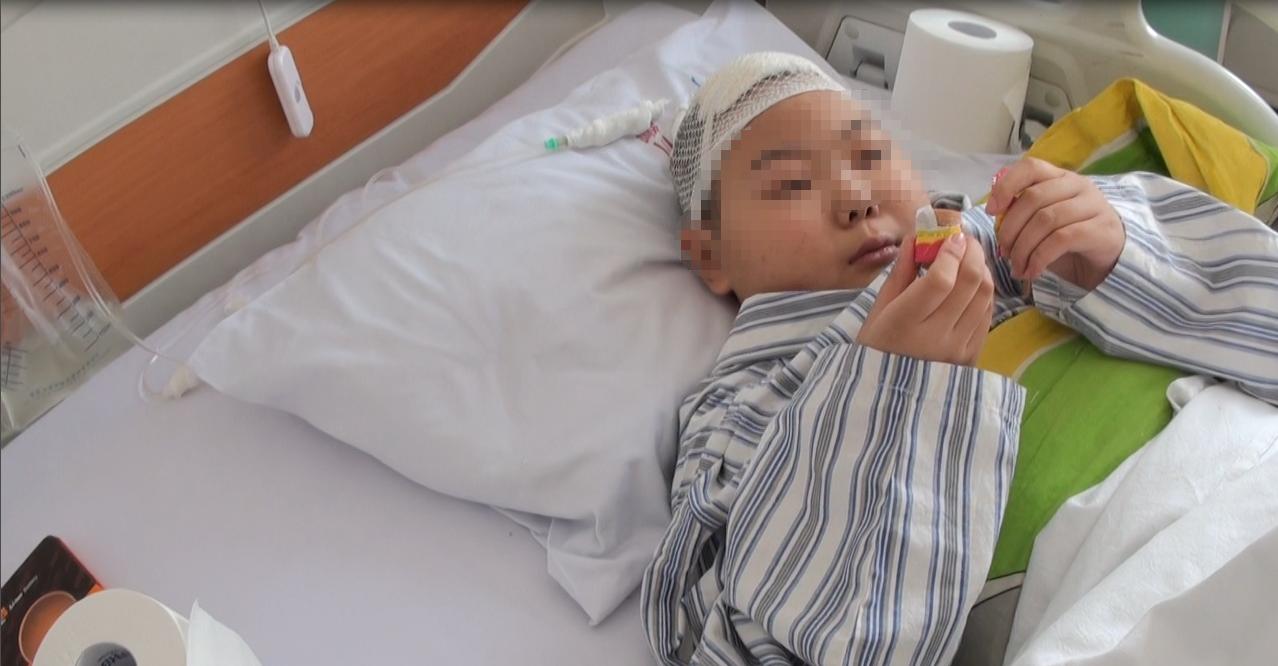 儿童结核脑膜炎脑积水,结核性脑膜炎脑积水如何引起