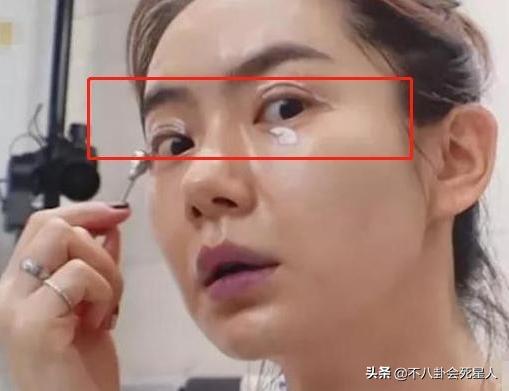 对双眼皮“下手”的明星：浮肿、宽大、失败返工，一个比一个狠