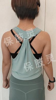 颈椎间盘突出压迫桡神经怎么恢复,颈椎间盘突出压迫手指麻怎么治疗