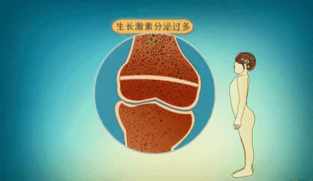 孩子身高突然长的很快怎么治疗,孩子身高长太快要警惕这种病