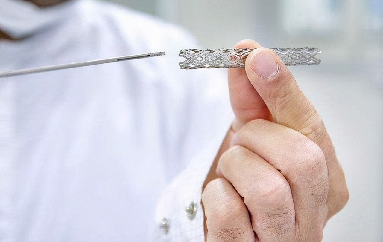 心脏支架手术可怕的吗 (心脏支架的严重后果)