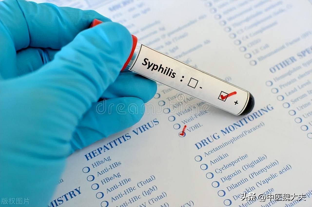 梅毒脚的这些典型表现!很多人却以为是脚气,白白耽误了病情