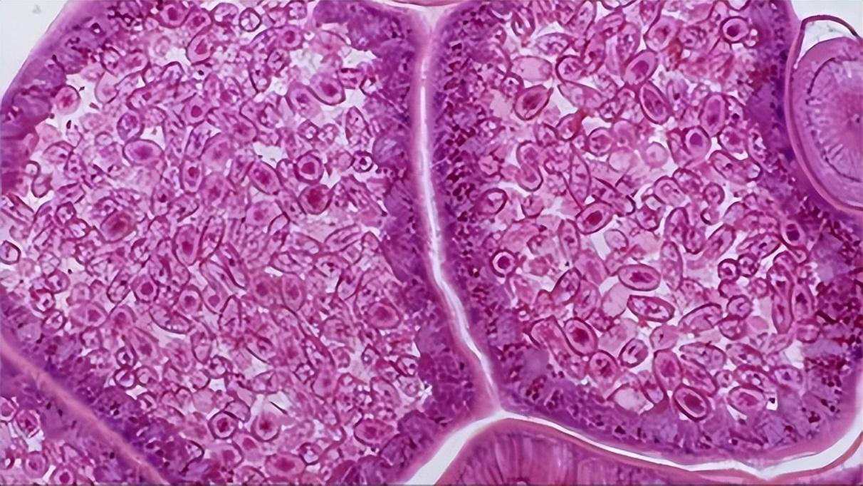 科普食物富含镁预防痴呆症,补充镁离子能预防老年痴呆吗