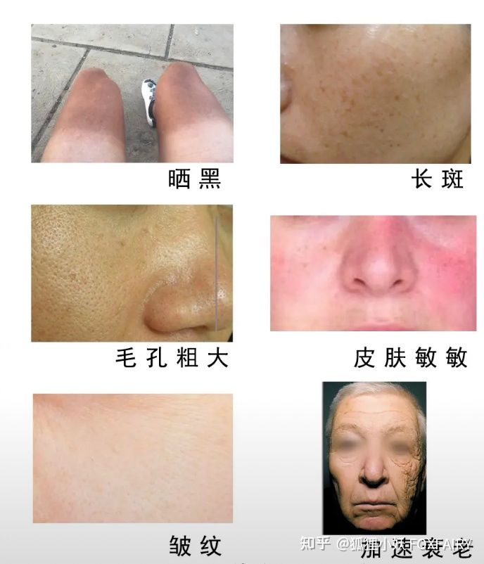 出门涂防晒的重要性科普分享,出门如何做到正确防晒